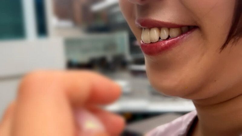 街角で声をかけて口内観察させてもらう パティシエ さらちゃん ギャラリー 2