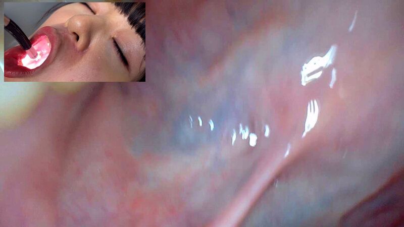 街角で声をかけて口内観察させてもらう 飲食店アルバイト みこちゃん ギャラリー 18