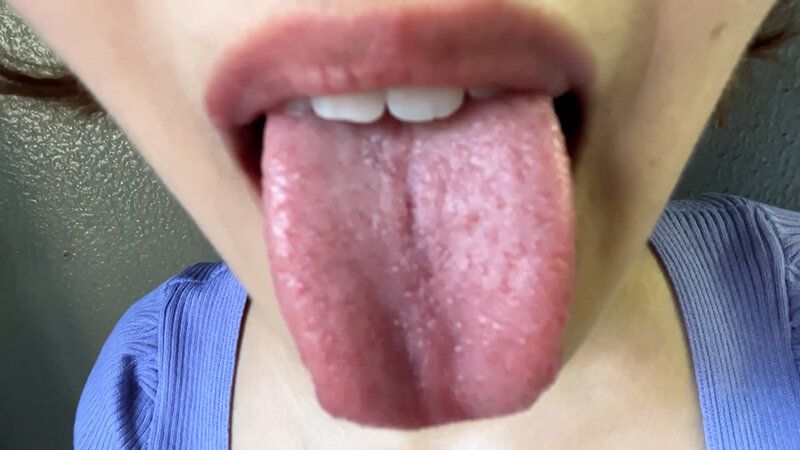 街角で声をかけて口内観察させてもらう アパレル店員 さつきちゃん ギャラリー 14