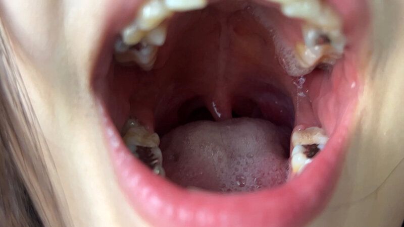 街角で声をかけて口内観察させてもらう アパレル店員 さゆりちゃん ギャラリー 5