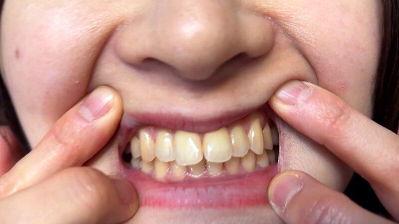 街角で声をかけて口内観察させてもらう 飲食店アルバイト みこちゃん ギャラリー 10