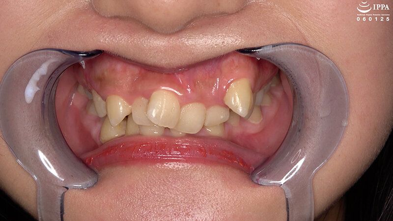 「【歯・口腔フェチ】新人女優相楽さゆなちゃんの口内観察＆巨大女フェチ」わかしラボWAKA-078 相楽さゆな 9 ギャラリー 2