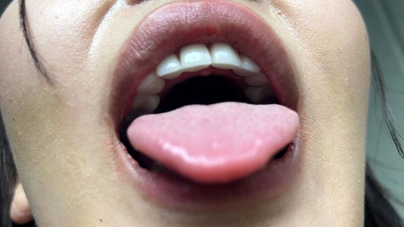 街角で声をかけて口内観察させてもらう エッチで金欠な女の子 ゆりなちゃん ギャラリー 9