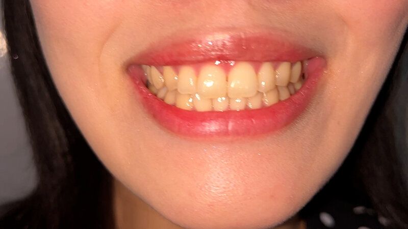 街角で声をかけて口内観察させてもらう スレンダーOL あいちゃん ギャラリー 6