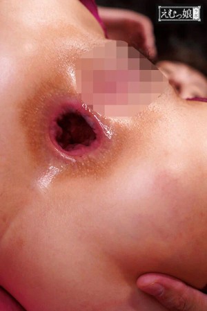 直径5cm級ヘブンズ肛門OPEN！尻穴に轟く鬼畜突きバーストで奥底まで丸見え！究極ぽっかりアナル30連発BEST ギャラリー 3