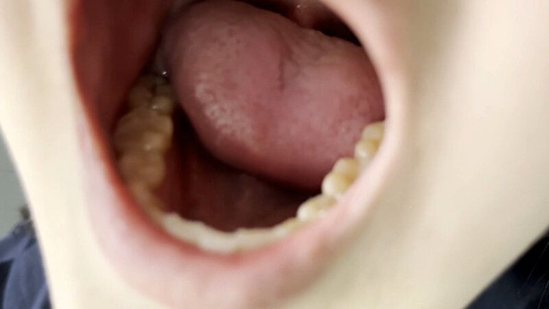 街角で声をかけて口内観察させてもらう 書店員 りかちゃん ギャラリー 7