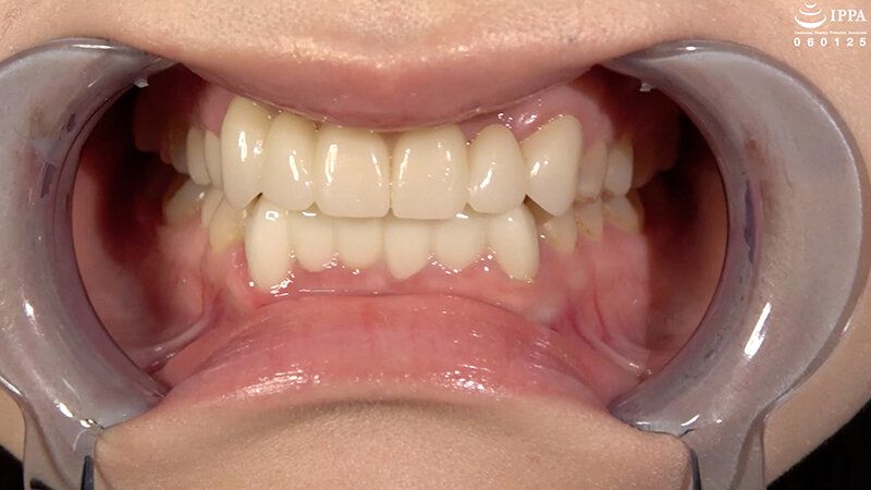 【歯・口腔フェチ】「超敏感女優 琥珀ややちゃんの口内観察＆巨大女フェチ」WAKA-077琥珀やや ギャラリー 2