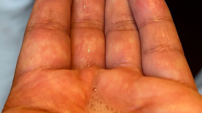 街角で声をかけて口内観察させてもらう カフェ店員 ひなちゃん ギャラリー 18