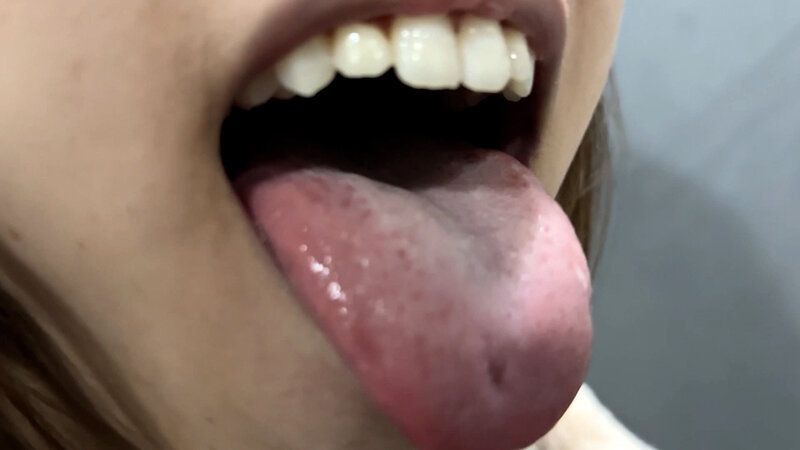 街角で声をかけて口内観察させてもらう オーガニックスーパー勤務 はつみちゃん ギャラリー 20