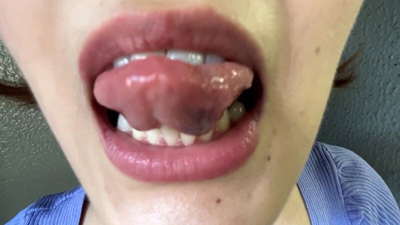 街角で声をかけて口内観察させてもらう アパレル店員 さつきちゃん ギャラリー 13