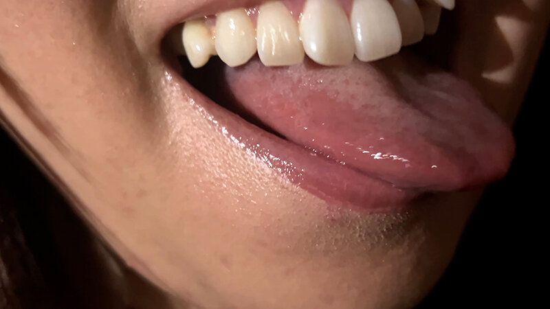 街角で声をかけて口内観察させてもらう 時計屋店員 みらいちゃん ギャラリー 12