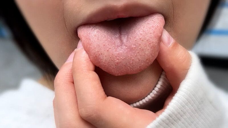 街角で声をかけて口内観察させてもらう 子供英語塾アルバイト のあちゃん ギャラリー 5