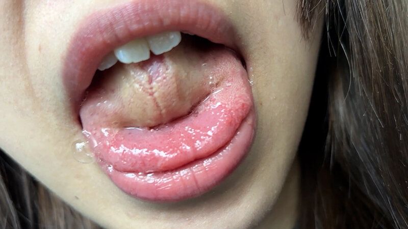 街角で声をかけて口内観察させてもらう 大学生 ゆゆちゃん ギャラリー 13