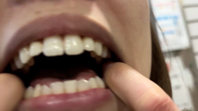 街角で声をかけて口内観察させてもらう オーガニックスーパー勤務 はつみちゃん ギャラリー 15