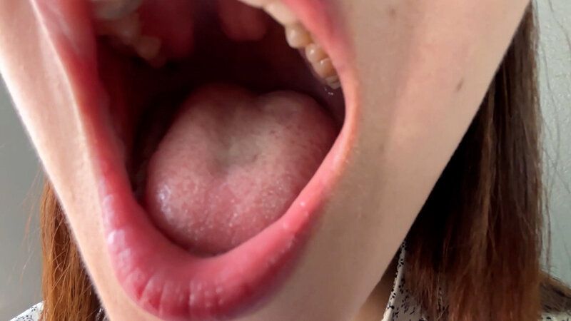 街角で声をかけて口内観察させてもらう ドラッグストア店員 あいるちゃん ギャラリー 5