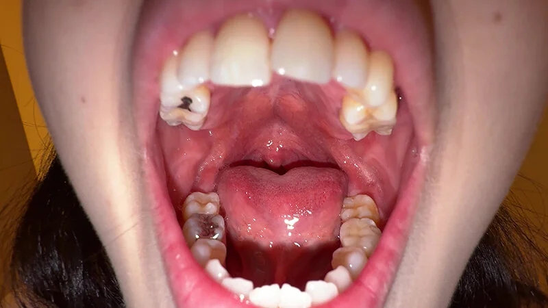 【個人撮影】横山夏希の喉チンコ触り＆肉厚舌を開口器で観察