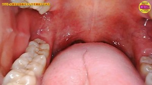 お口の中をじっくり見せてくれませんか？～アパレル店員はるのさん～ 安堂はるの ギャラリー 4