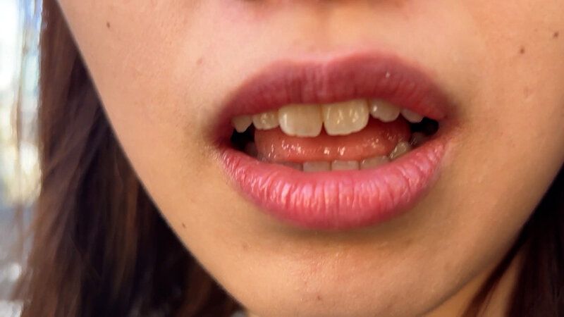 街角で声をかけて口内観察させてもらう 大学生 ゆゆちゃん ギャラリー 5