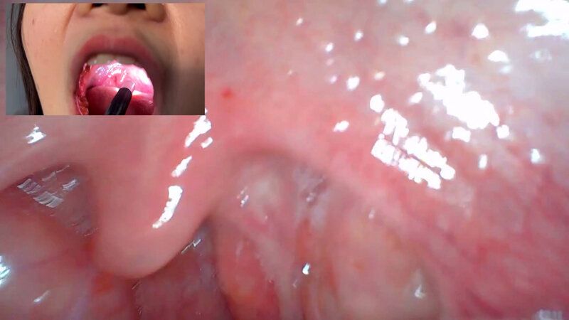 街角で声をかけて口内観察させてもらう 飲食店アルバイト みこちゃん ギャラリー 13