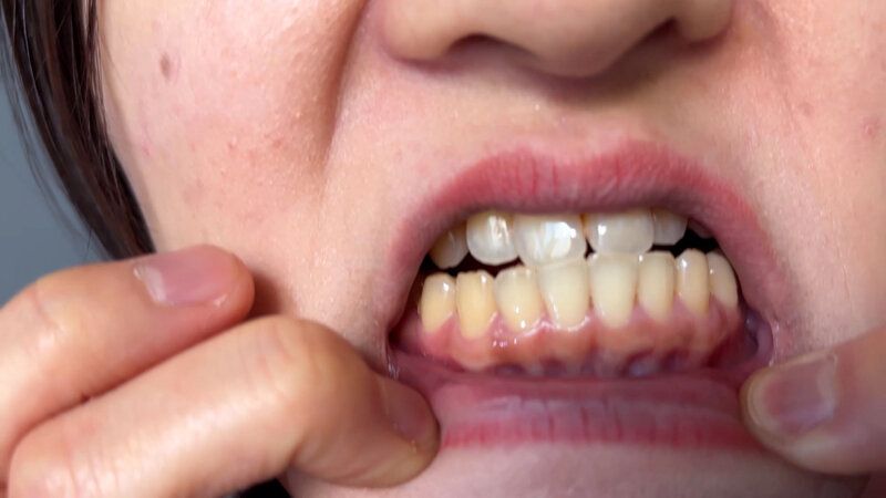 街角で声をかけて口内観察させてもらう 飲食店アルバイト みこちゃん ギャラリー 12