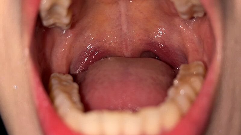 街角で声をかけて口内観察させてもらう スレンダーOL あいちゃん ギャラリー 8