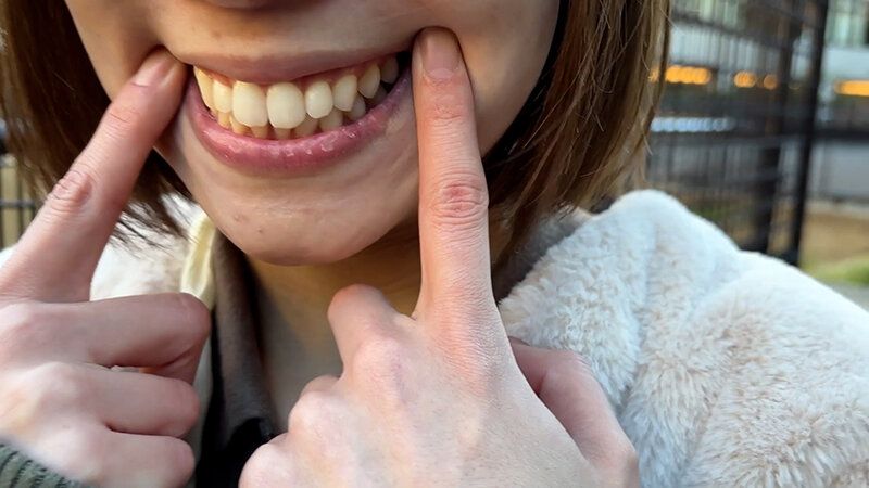 街角で声をかけて口内観察させてもらう オーガニックスーパー勤務 はつみちゃん ギャラリー 3