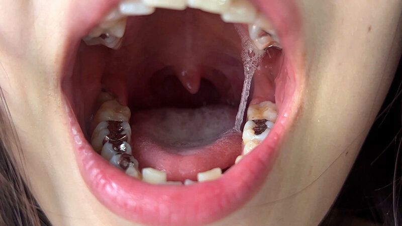 街角で声をかけて口内観察させてもらう アパレル店員 さゆりちゃん ギャラリー 4