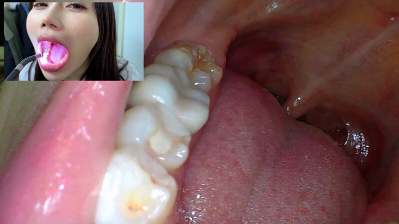 街角で声をかけて口内観察させてもらう アパレル関係 ひなみちゃん ギャラリー 11