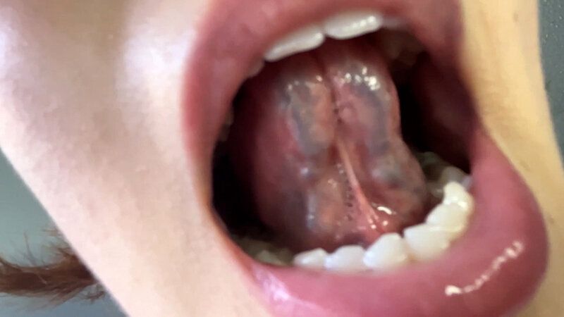 街角で声をかけて口内観察させてもらう アパレル店員 さつきちゃん ギャラリー 17