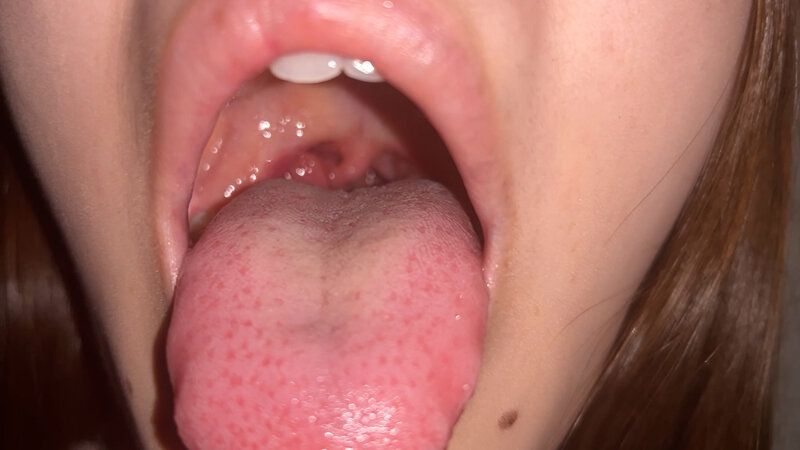 街角で声をかけて口内観察させてもらう 福祉系の専門学生 なぎさちゃん ギャラリー 8