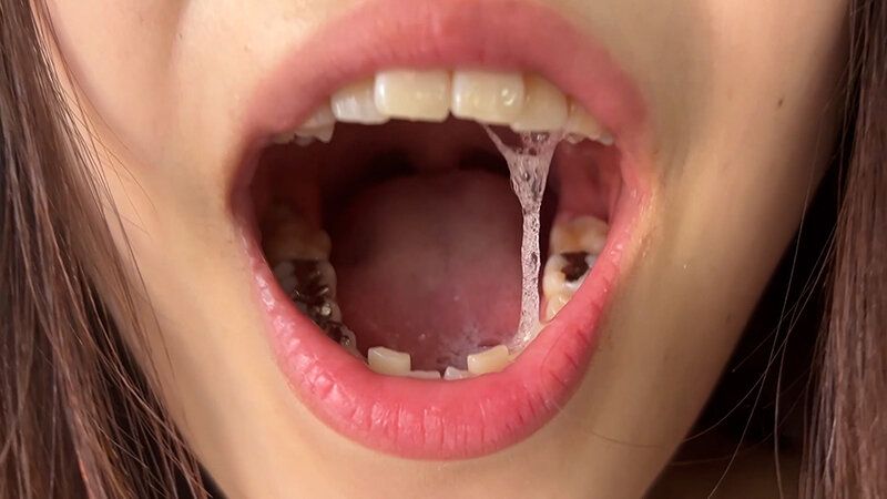 街角で声をかけて口内観察させてもらう アパレル店員 さゆりちゃん ギャラリー 19