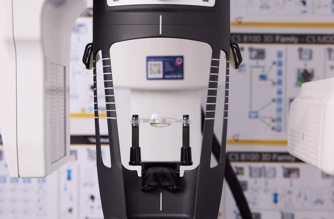 CBCT Scan Explained | 3D Dental Imaging at Precision Dental Clinic