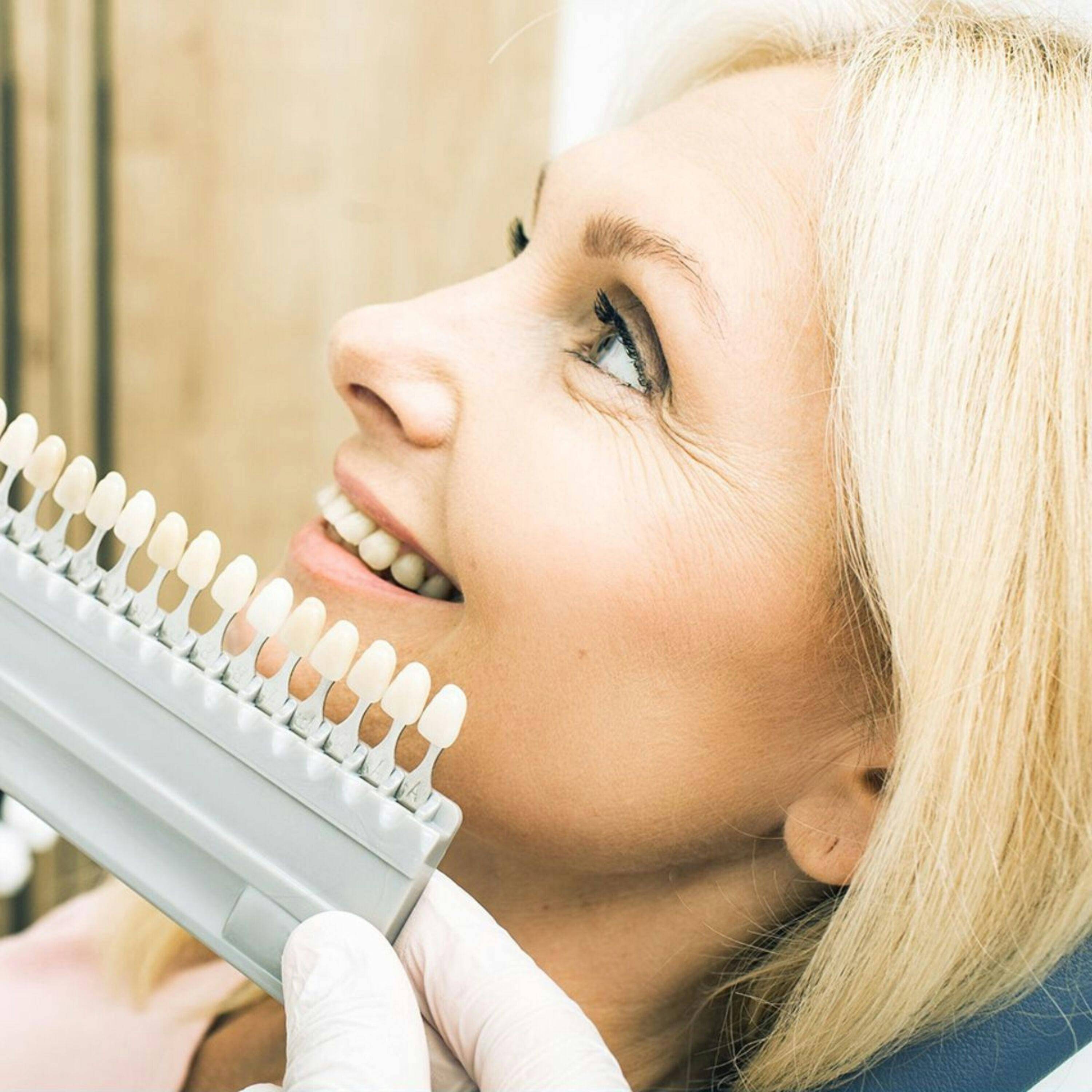 female patient smiling in the sun while dentist in white gloves matches tooth shade from samples