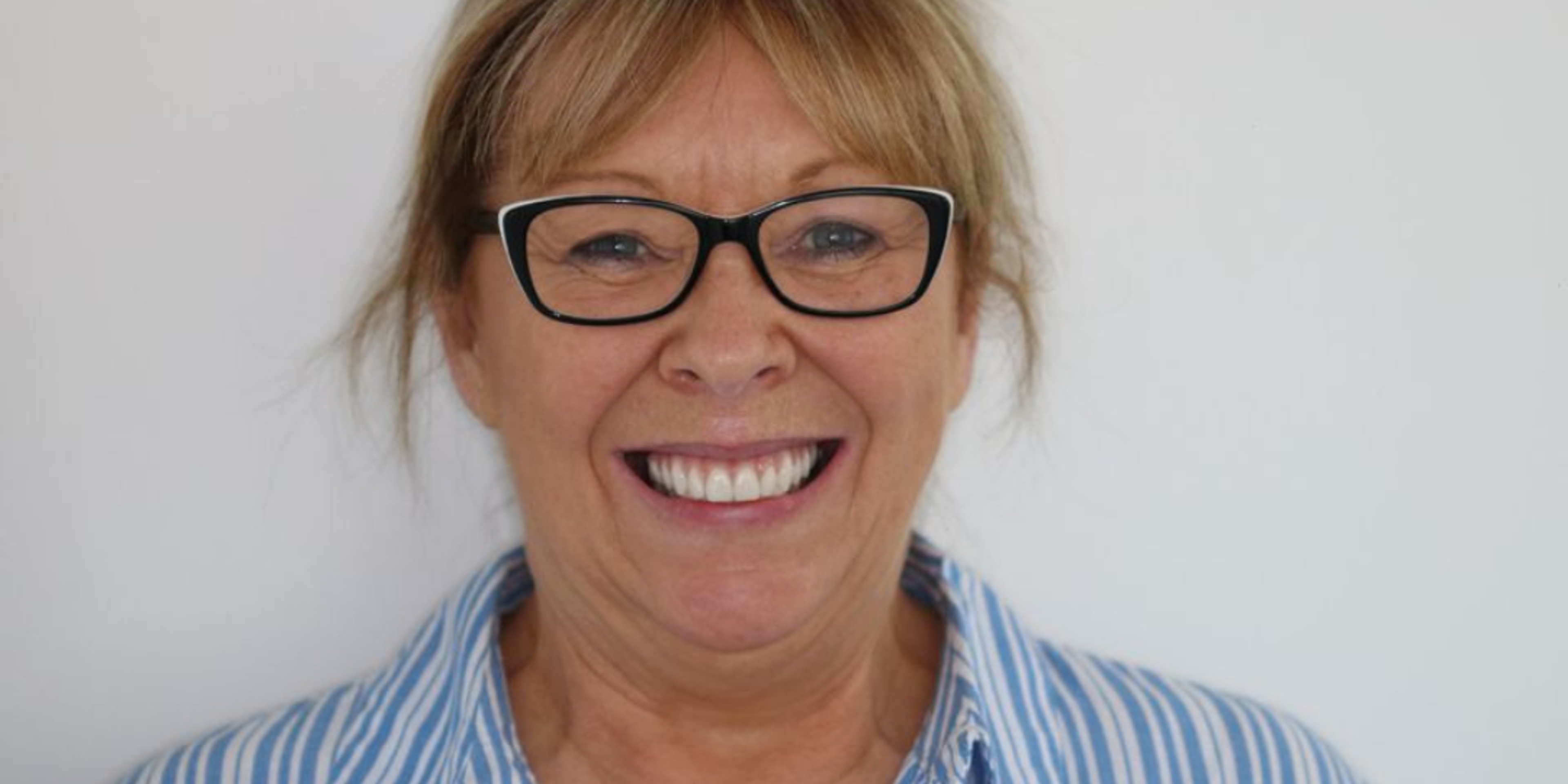 After dental implant retained denture showing beautiful lady with white healthy straight teeth