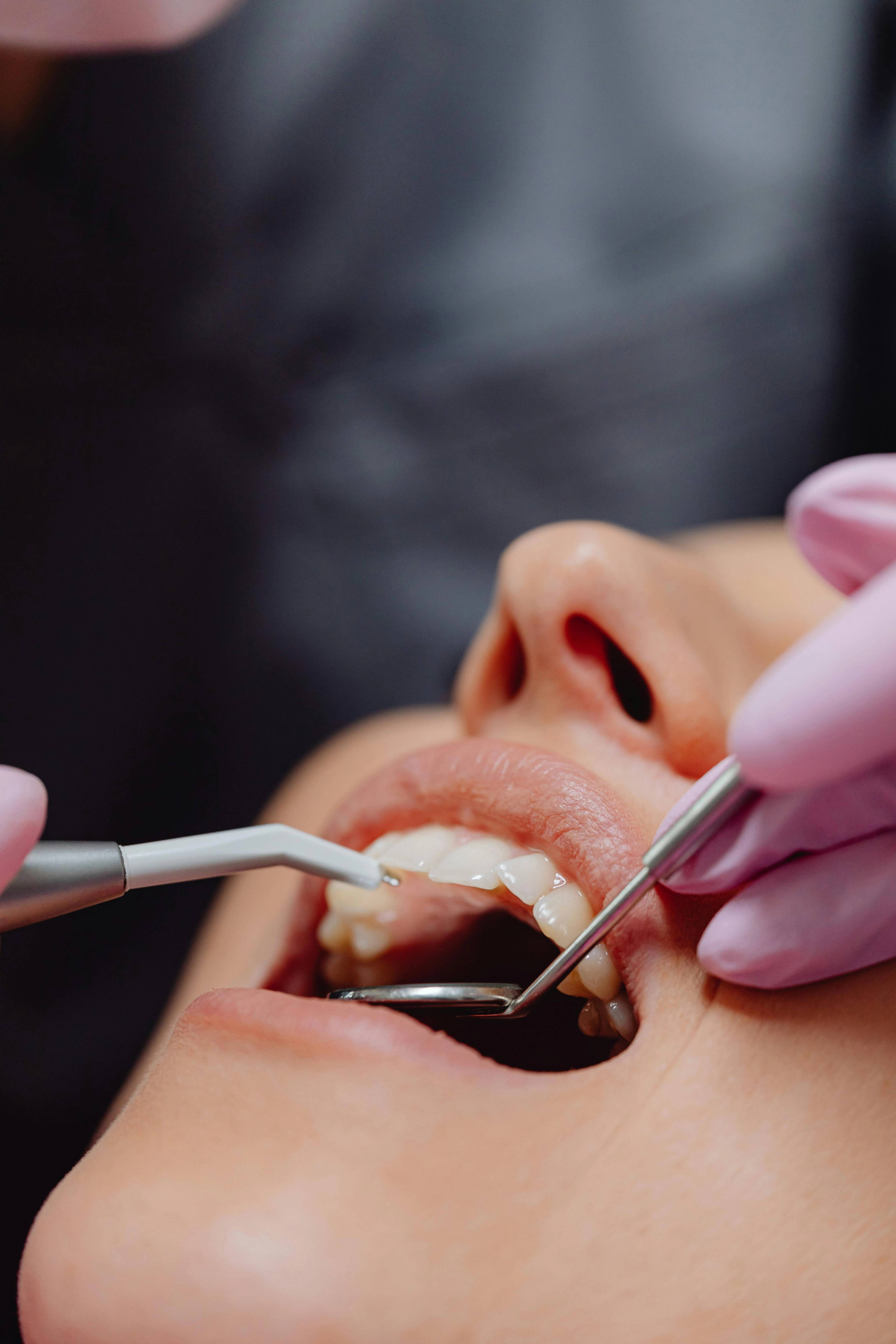 Close up of dentist holding dental check up instruments at patients mouth