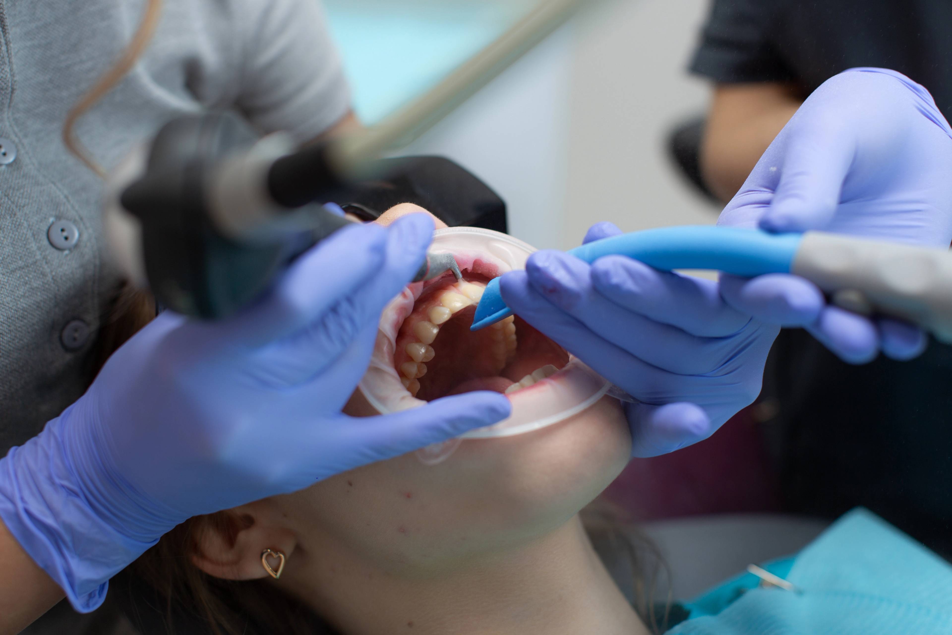 patient having a scale and polish by a clinician in a dental surgery