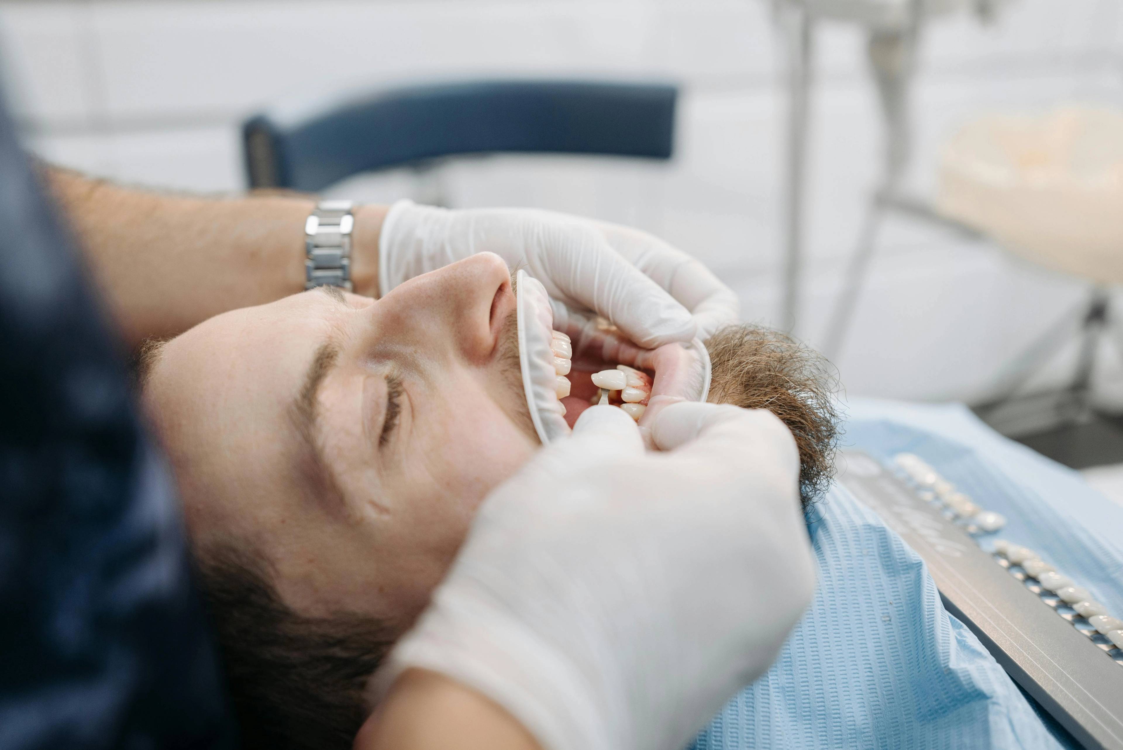 male patient in dental chair with dentist hand holding tooth shade next to lower teeth in preparation for treatment