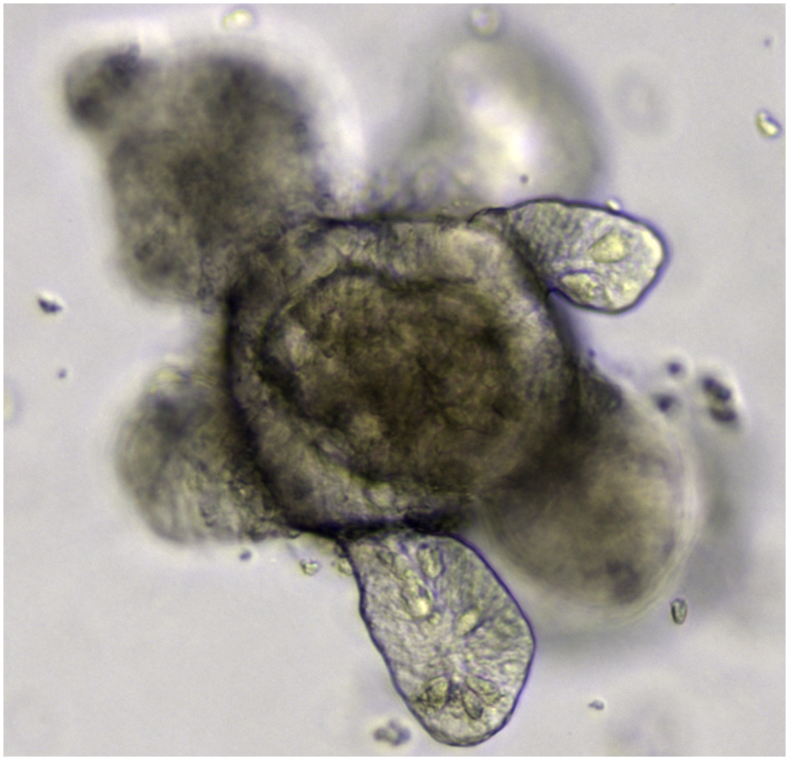 Microscopy of an intestinal organoid grown from Lgr5-positive stem cells