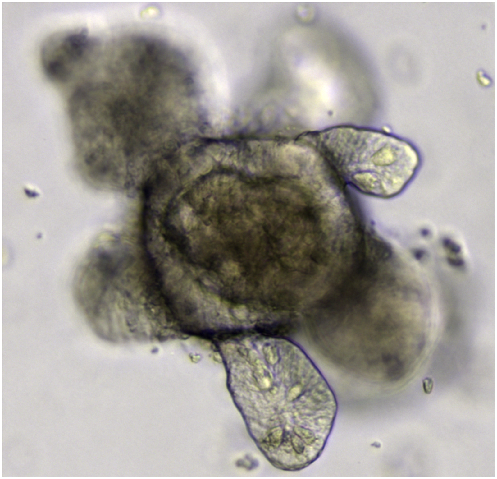 Microscopy of an intestinal organoid grown from Lgr5-positive stem cells