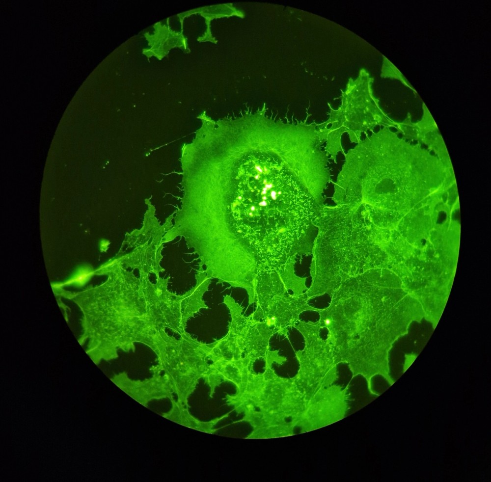 Green fluorescence microscopy of the actin cytoskeleton in cultured cells