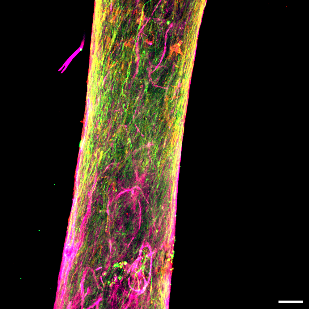 Confocal immunofluorescence of a regenerating sciatic nerve after implantation
