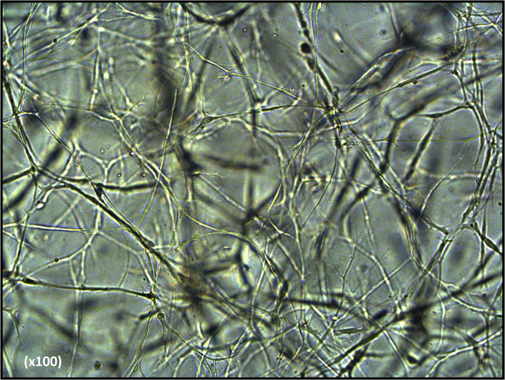 Stem cells forming a connected three-dimensional network inside a hydrogel scaffold