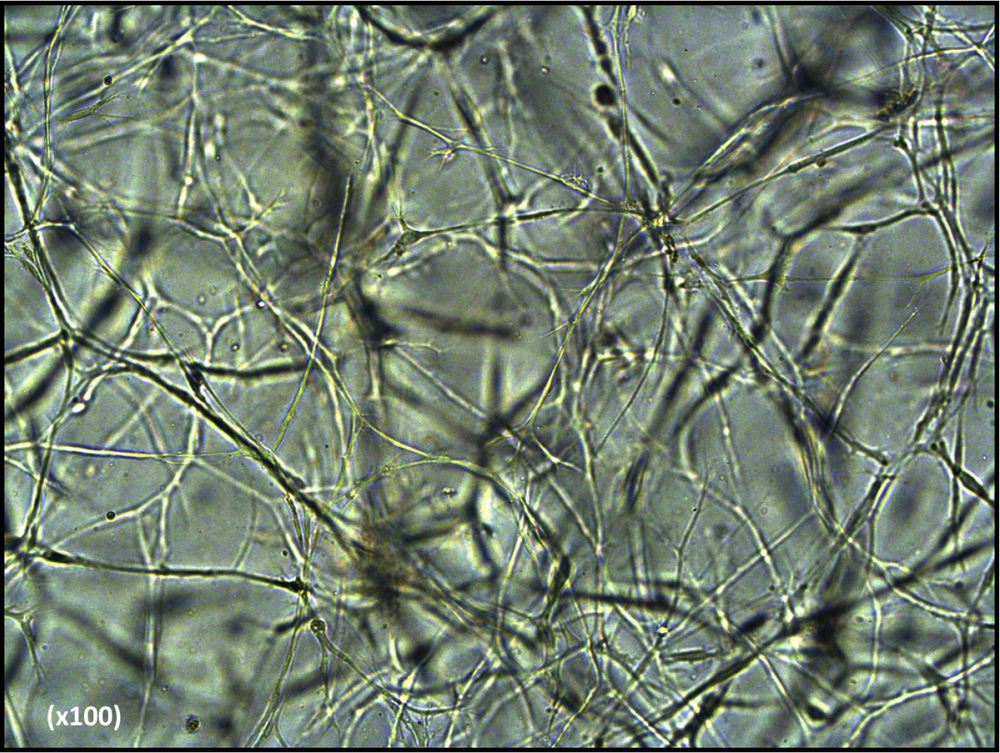 Stem cells forming a connected three-dimensional network inside a hydrogel scaffold
