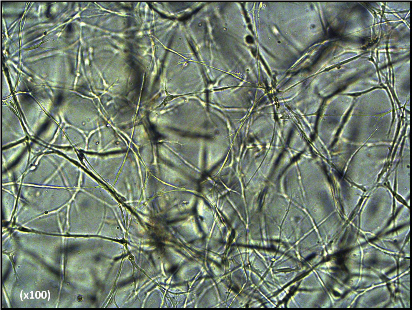 Stem cells forming a connected three-dimensional network inside a hydrogel scaffold