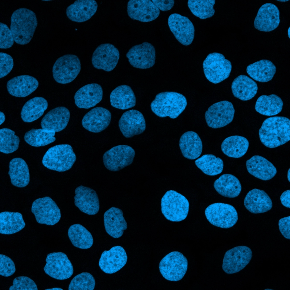 Confocal fluorescence micrograph of human keratinocyte nuclei stained with DAPI