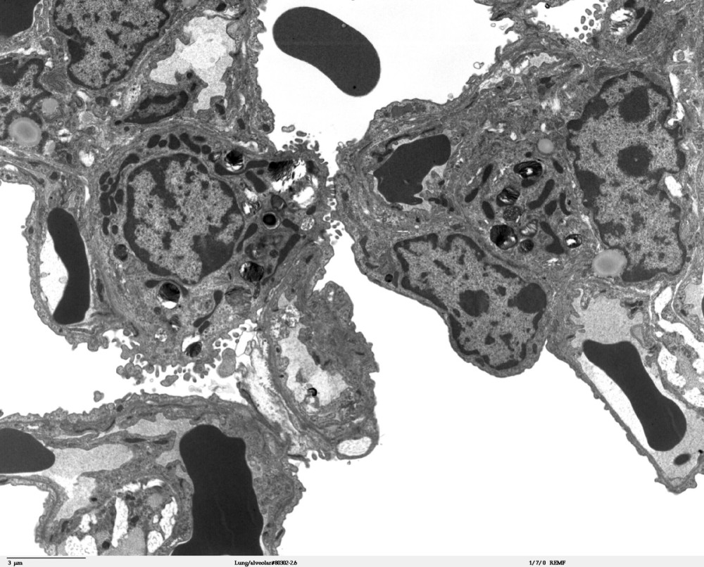 Transmission electron microscopy of the alveolar region of the lung