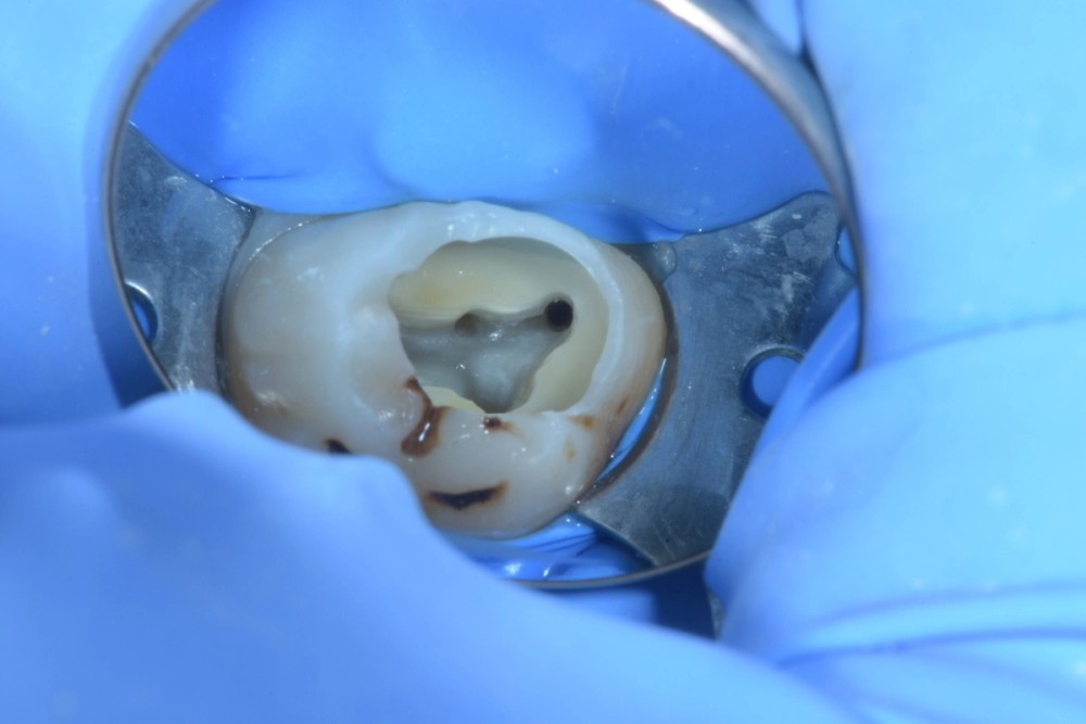 High-resolution internal morphology of a human molar