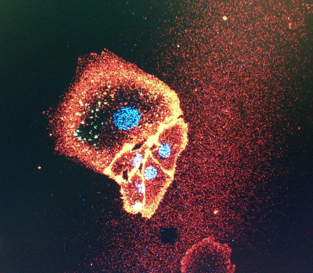 High-resolution fluorescence microscopy of human cells and their cytoskeleton