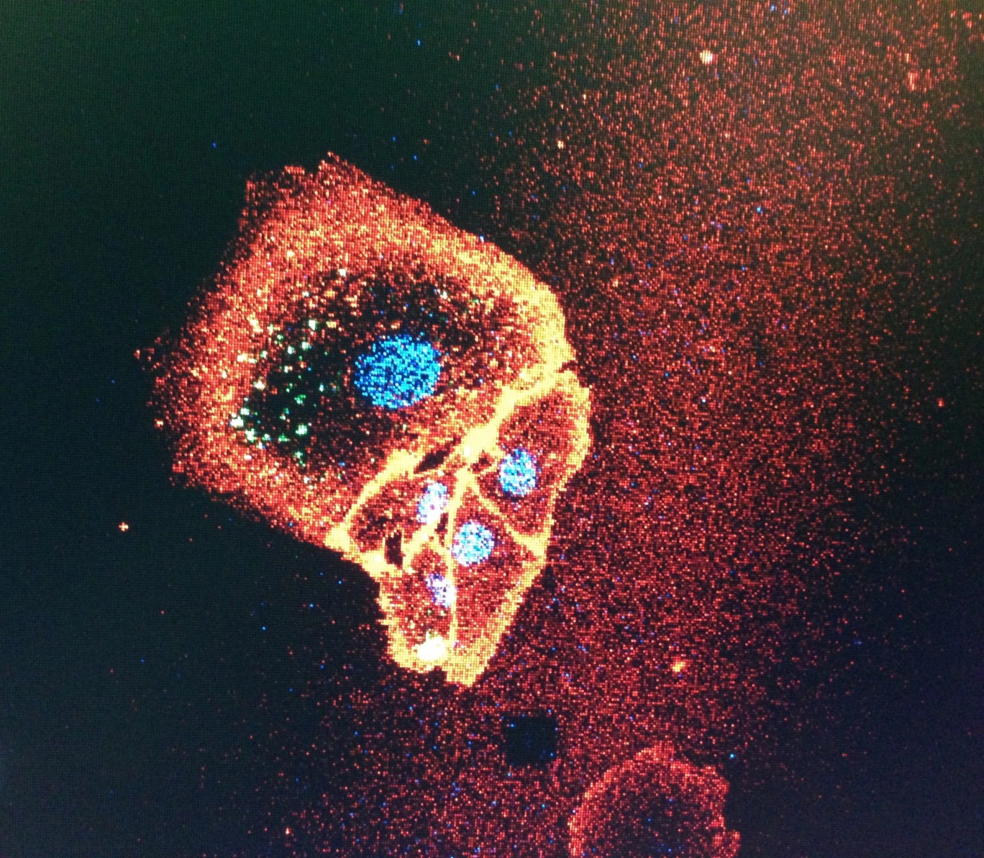 High-resolution fluorescence microscopy of human cells and their cytoskeleton