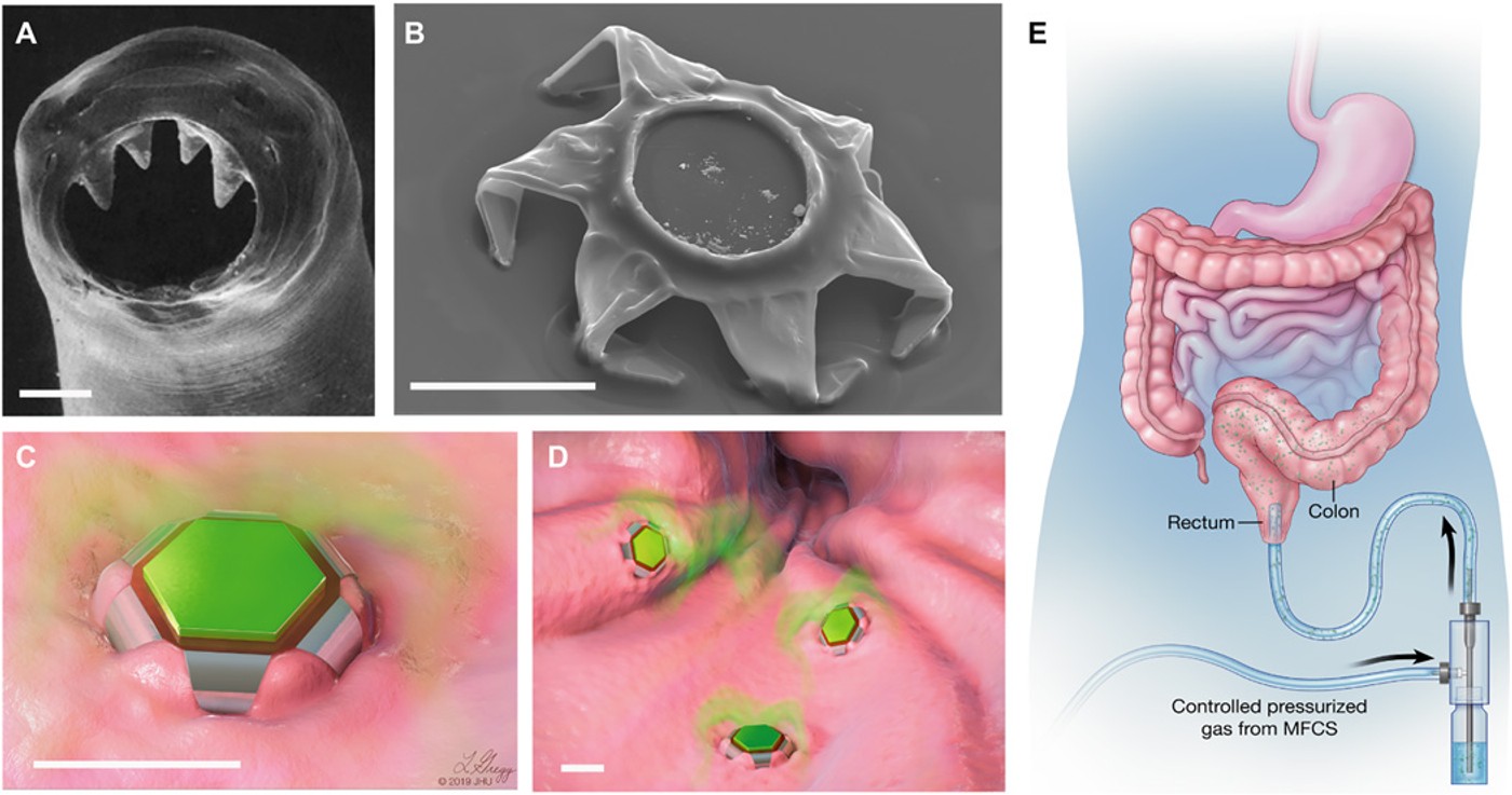 Shape-changing theragrippers designed for local drug delivery